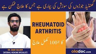 Ghantiya Ka Ilaj - Rheumatoid Arthritis Treatment - Joron Ke Dard Ka Elaj - Arthritis Causes Symptom