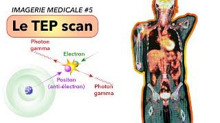 IMAGERIE MEDICALE #5 : Le TEP scan