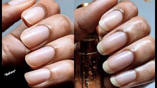 How to grow your natural nails out in 24 days 