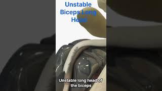 Unstable Biceps Long Head Rupture: What Happens And What's The Reason