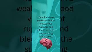 Types of Stroke