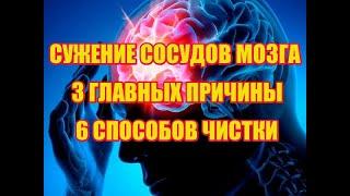 СУЖЕНИЕ СОСУДОВ МОЗГА. ПРИЧИНЫ. 6 способов очищения сосудов головного мозга