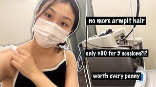 EM IN KOREA  | My Armpit Hair Removal Experience