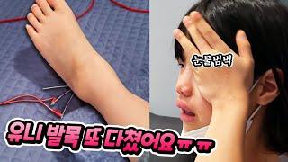 유니 발목 또 다쳤어요 !! 이번엔 반대쪽을 ㅠㅠ 마지막 유니의 반전 모습 ?? 별난가족 일상 브이로그 유니의 성장 스토리 byulnan family