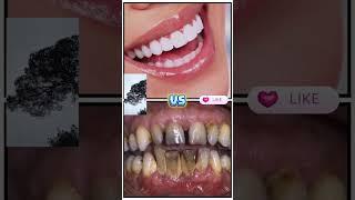 #choose Lisa Or Lena #new # #funnyvideo #funny #tiktok #viralvideo فقط#  للبنات لوخيروك #شفا