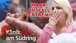 Extremer Haarausfall! Lässt sich die Besucherin untersuchen? | Klinik am Südring | SAT.1