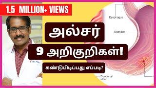 அல்சர்/வயிற்றுப்புண் 9 அறிகுறிகள் என்ன? கண்டுபிடிப்பது எப்படி?/ Ulcer: Symptoms & Diagnosis