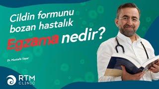 Cildin Formunu Bozan Hastalık: Egzama