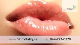 Juvederm Toronto Skin Vitality Medical Clinic