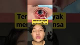 TERLALU BANYAK MEMAKAI LENSA #viral