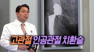 명의 헬스케어 - 고관절 인공관절 치환술