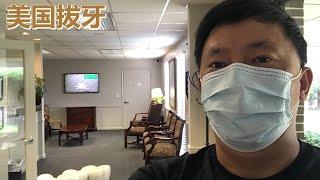 美国拔牙贵不贵？一个月牙科保险就能免费拔牙？Is dental hygienist expensive in US? Free for one month's dental insurance?