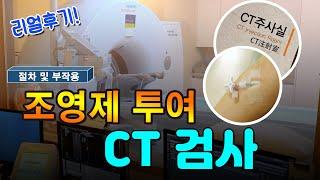 조영제 투여하는 CT검사 과정과 부작용  하지 혈관 조영 CT