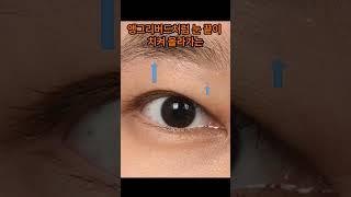 젊은 눈썹하거상의 문제 - 제이제이성형외과#shorts