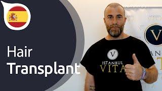 My Experience with Istanbul Vita from Spain | Hair Transplant in Istanbul / Turkey