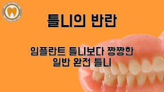 틀니의 반란 : 임프라트 틀니보다 짱짱한 일반 완전틀니