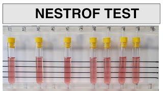 NESTROF test