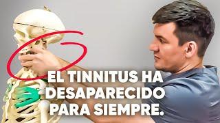 Las 3 principales causas del tinnitus. ¡Hice esto y todo desapareció!