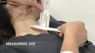 Cardiac Exam - Jugular Venous Distension