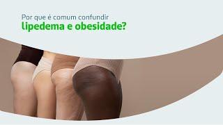 Lipedema ou obesidade? Entenda por que elas podem ser confundidas