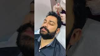 Scalp PRP treatment #prp #prptreatment #exosomes #haircare