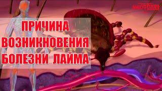 Причины болезни Лайма (клещевой боррелиоз, Лайм-боррелиоз)