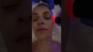 Stem Cell Facial Glowing Results!