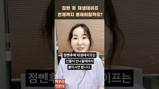 점빼고 난뒤 붙이는 재생테이프 언제까지 붙여야할까요?