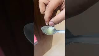 Dry cough - Ayurveda solution | kids | Allergy | coughing