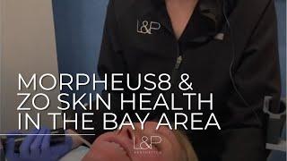 Morpheus8 and ZO Skin health in the Bay Area