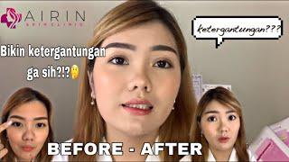 Airin Beauty Care - Honest Review Skincare || JERAWAT ILANG???