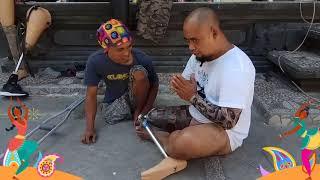 Kaki palsu bali ronald regen