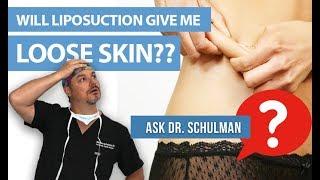 Will Liposuction Give Me Loose Skin?  Ask Dr Schulman