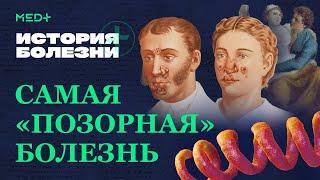 Сифилис. Первые признаки заражения, диагностика и лечение | История болезни