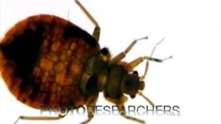 Bed Bug Close-up - Photo Researchers