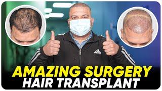 Hair Transplant in Bikaner | Best Results & Cost of Hair Transplant in Bikaner