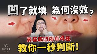 忽略這點，法令紋治療就無效！鼻基底凹？不是每個人都適合貴族手術！教你居家檢測自己是哪種法令紋？｜依心唯美 李京軒醫師