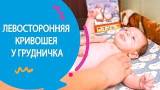 ЛЕВОСТОРОННЯЯ КРИВОШЕЯ У ГРУДНИЧКА 2 МЕСЯЦА