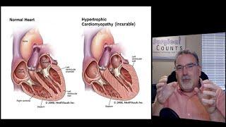 Surgical Technology Preview - Cardiac Surgery