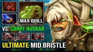 How to Solo Mid Bristleback Against Cancer Huskar with Max Quill Spray Damage Epic Dota 2