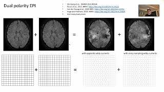 Low spatial-frequency ripple artifacts in layer-fMRI EPI: Renzo Huber