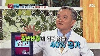 눈에 좋은 '블루베리 효소' 오히려 황반변성을 초래한다? 닥터의 승부 99회