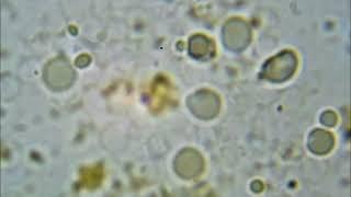 Spirochetes turn into L forms or spheroplasts