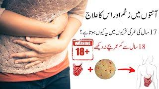 Anton K Zakham Ka Ilaj | Anto Me Infection Ka ilaj | Intestine Infection Treatment in Urdu |