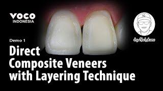 Direct Composite Veneers with Layering Technique using AMARIS | Operative Dentistry | VOCO GmbH