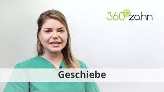 Geschiebe - Was ist ein Geschiebe? | Dental-Lexikon | 360°zahn