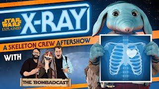 Skeleton Crew - Episode Three LIVE Discussion with Bombadcast - X-Ray