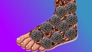 ASMR Animation Treatment Infected Leg | ASMR Collection | 2D ASMR Animation Treatment  @BiswaAsmr