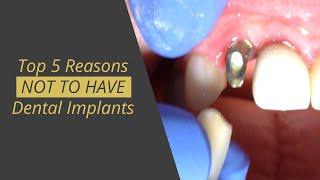 5 Reasons that Dental Implant Are NOT as good as teeth