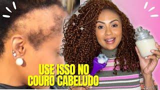 O CABELO CRESCE LOUCAMENTE E NÃO CAI! QUERATINA NATURAL! DEIXA O CABELO MACIO E SEDOSO